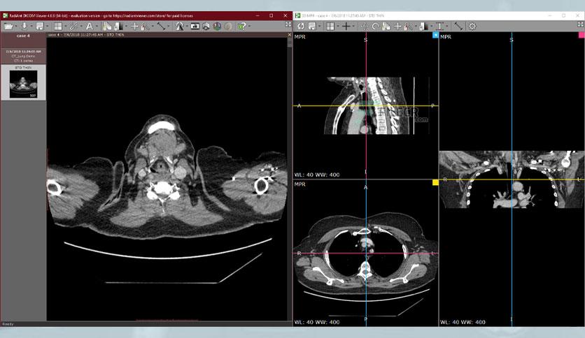 radiant dicom viewer for mac free download