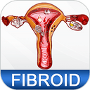 Uterine Fibroid Treatment Help v2.1